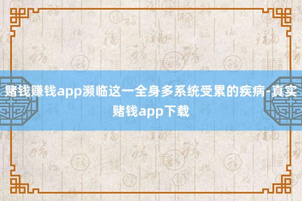 赌钱赚钱app濒临这一全身多系统受累的疾病-真实赌钱app下载